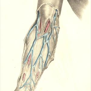 Spider Vein Clinics - A Review Of Laser Treatment For Varicose Veins