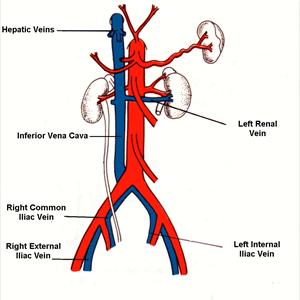 Lingual Varicosities Meaning - Sclerotherapy Vein Treatment - Explained